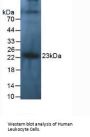 Interleukin 10 (IL10) Antibody