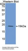 Interleukin 15 (IL15) Antibody