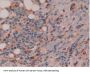 Interleukin 16 (IL16) Antibody