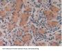 Interleukin 16 (IL16) Antibody