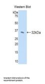 Janus Kinase 2 Antibody