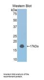 Tyrosine-Protein Kinase JAK2 (JAK2) Antibody