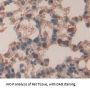 Tyrosine-Protein Kinase JAK2 (JAK2) Antibody