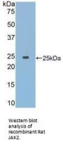 Tyrosine-Protein Kinase JAK2 (JAK2) Antibody