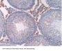 Tyrosine-Protein Kinase JAK2 (JAK2) Antibody