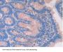 Tyrosine-Protein Kinase JAK2 (JAK2) Antibody