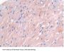 Tyrosine-Protein Kinase JAK2 (JAK2) Antibody