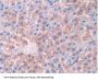 Tyrosine-Protein Kinase JAK2 (JAK2) Antibody