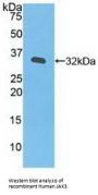Tyrosine-Protein Kinase JAK3 (JAK3) Antibody