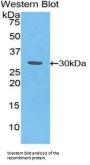 Tyrosine-Protein Kinase JAK3 (JAK3) Antibody