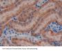 Tyrosine-Protein Kinase JAK3 (JAK3) Antibody