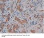 Kallikrein 10 (KLK10) Antibody