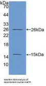 Proliferation Marker Protein Ki-67 (MKI67) Antibody