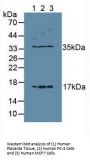 Proliferation Marker Protein Ki-67 (MKI67) Antibody