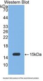 Myeloperoxidase (MPO) Antibody