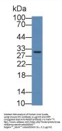 Neurofibromin 2 (NF2) Antibody