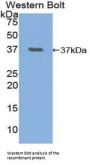 Neurofibromin 2 (NF2) Antibody