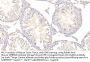Thymosin Beta 4 (TMSB4) Antibody