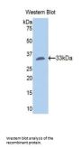 Fibrinogen Gamma (FGG) Antibody