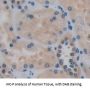 Inhibin Beta B (INHbB) Antibody