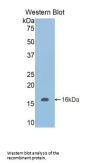 Inhibin Beta B (INHbB) Antibody