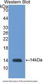 Inhibin Beta B (INHbB) Antibody