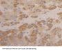 Inhibin Beta C (INHbC) Antibody
