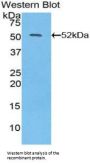 Interferon Beta (IFNb) Antibody