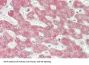 Interferon Beta (IFNb) Antibody