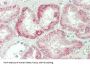 Interferon Beta (IFNb) Antibody