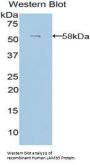 Laminin Beta 3 (LAMb3) Antibody