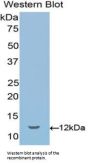 Semaphorin 3E (SEMA3E) Antibody