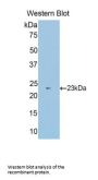 Sulfite Oxidase (SUOX) Antibody