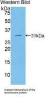 Tubulin Epsilon (TUBe) Antibody
