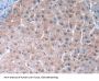 Tubulin Epsilon (TUBe) Antibody