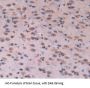 Tubulin Epsilon (TUBe) Antibody
