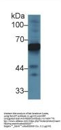 alpha Fetoprotein Antibody