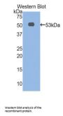 alpha Fetoprotein Antibody