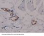 alpha Fetoprotein Antibody