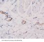 alpha Fetoprotein Antibody