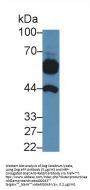 Alpha Fetoprotein (AFP) Antibody