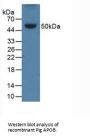Apolipoprotein B Antibody
