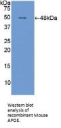 Apolipoprotein E (APOE) Antibody