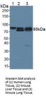 Catenin Beta 1 (CTNNb1) Antibody