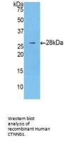 Catenin Beta 1 (CTNNb1) Antibody