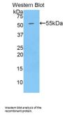 Golgi Protein 73 Antibody
