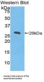 Integrin Beta 2 (ITGB2) Antibody