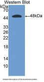 Interferon Alpha (IFNa) Antibody
