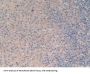 Interferon alpha Antibody
