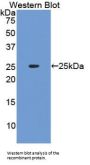 Interferon Alpha (IFNa) Antibody